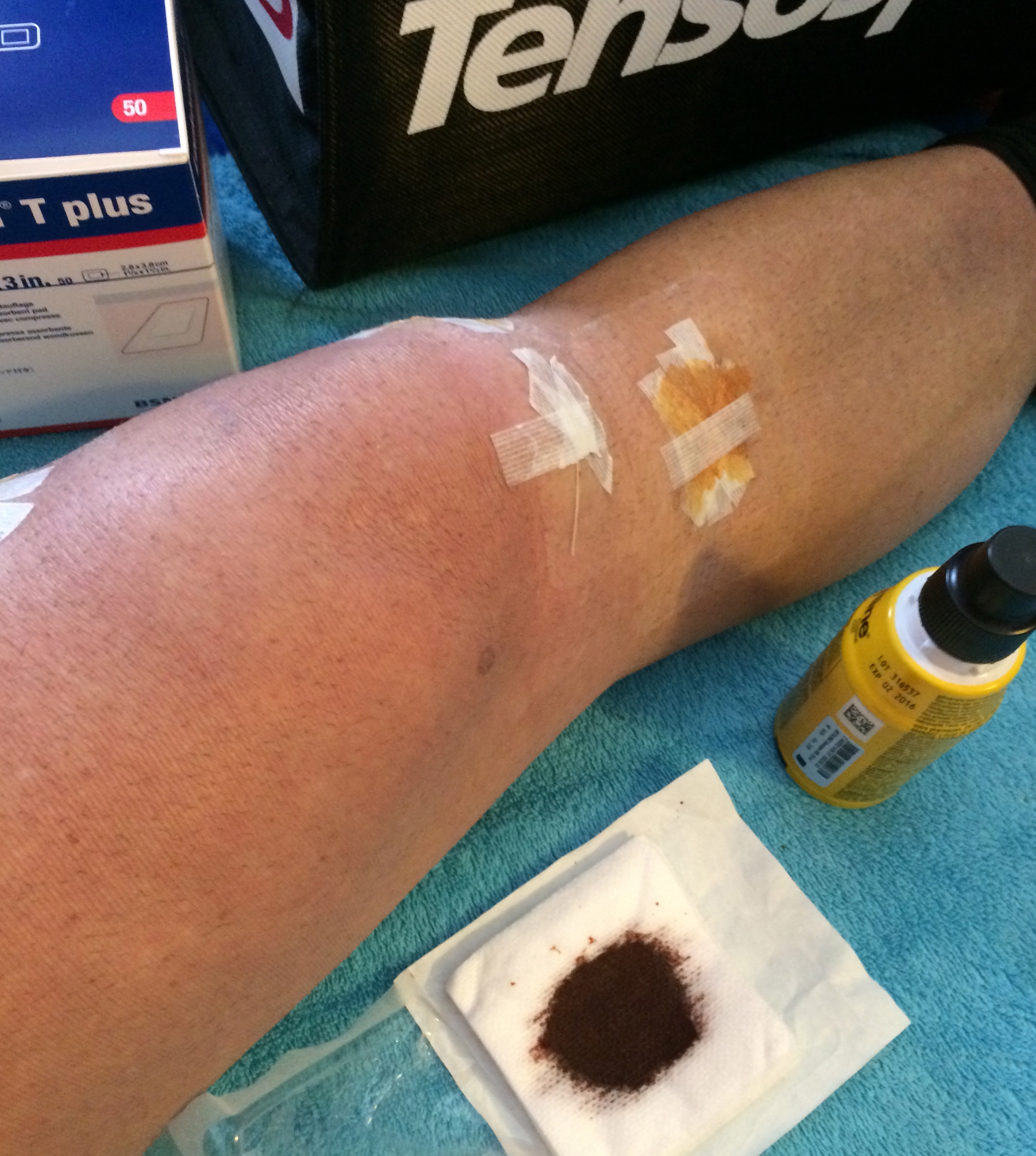 Acide hyaluronique et ligamentoplastie du genou pour rupture du ligament croisé antérieur.